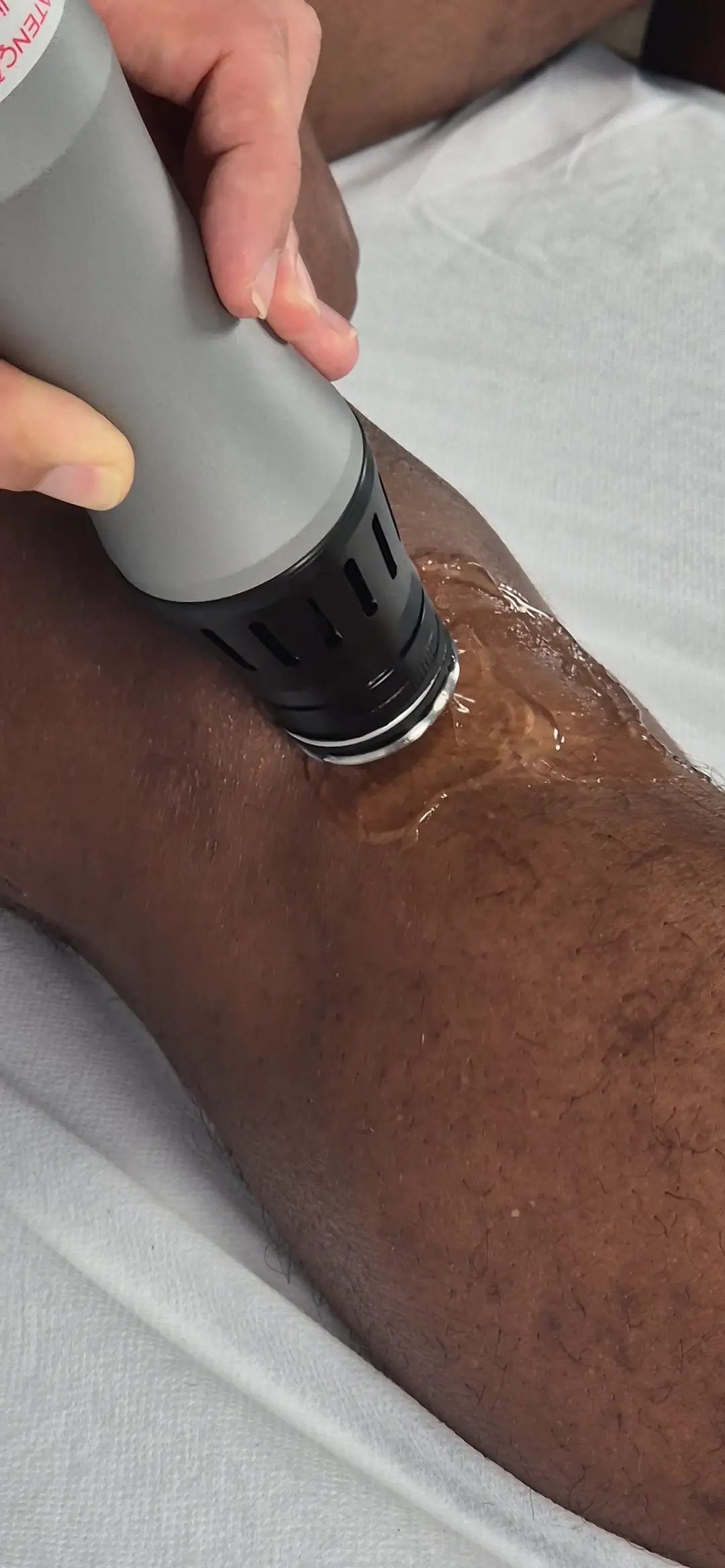 Aplicação real da terapia por ondas de choque no joelho de um paciente